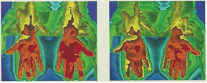 Thermo Image 1